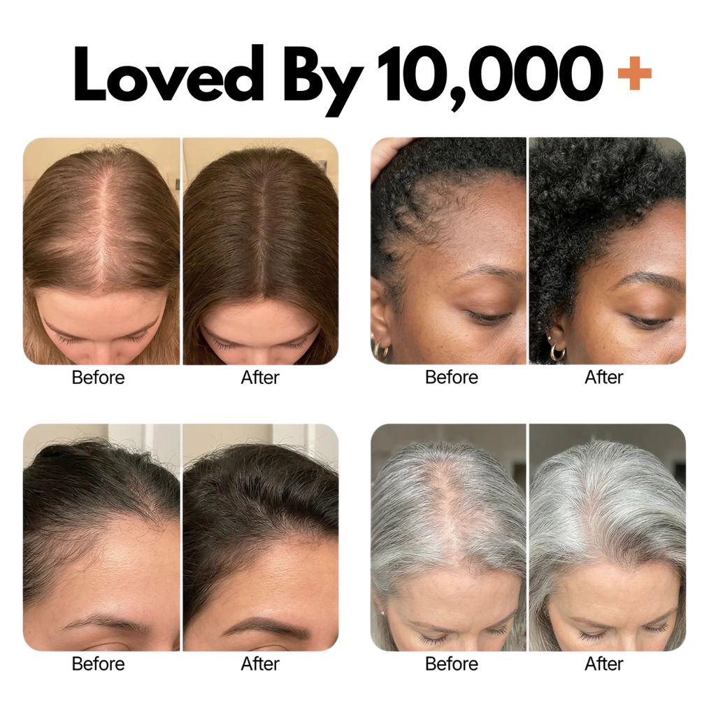 Aume® - Korea's #1 Hair Growth Serum